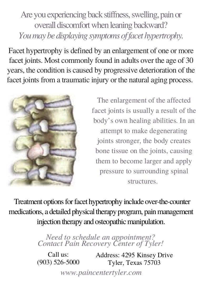 Facet Hypertrophy Pain Management Physician Tyler TX