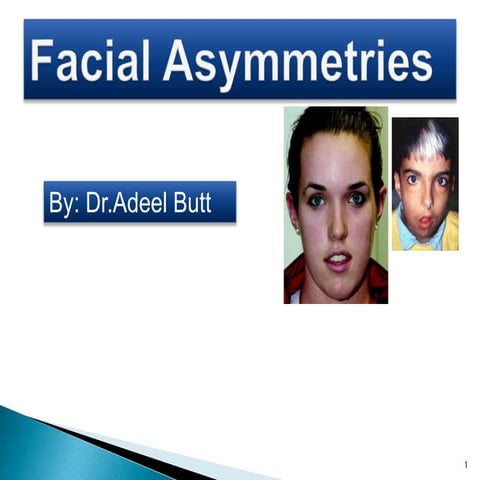 Facial asymetries
