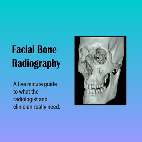 clinical use of waters projection in determining sinus problems | PPTX