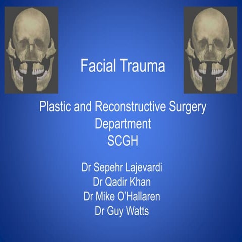 Facial Trauma
