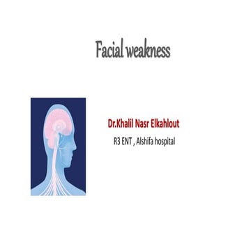 Facial weakness.pptx