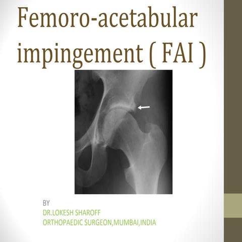 Femoro-acetabular impingement syndrome
