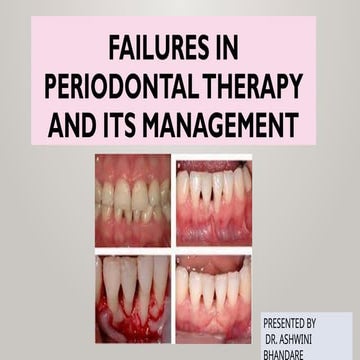 Supportive Periodontal Therapy Part 1 | PPTX