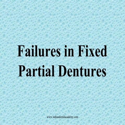 Failures in fixed partial dentures /certified fixed orthodontic courses by In...