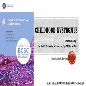 Childhood Nystagmus AAO Pediatric and Strabismus
