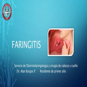Faringitis