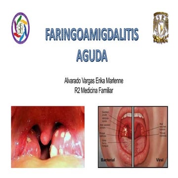 Faringoamigdalitis GPC TRATAMIENTO Y CRITERIOS.pptx
