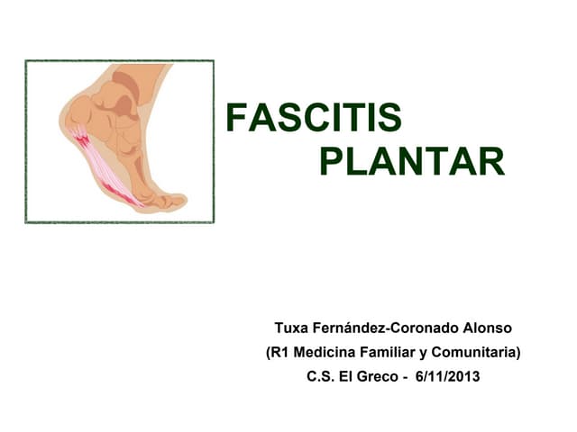 Fascitis plantar