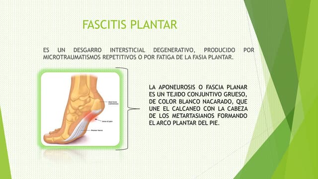 Fascitis plantar y juanete ( hallux...