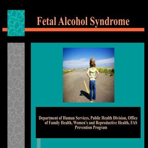 FETAL ALCOHOL SYNDROME(FAS) | PPTX