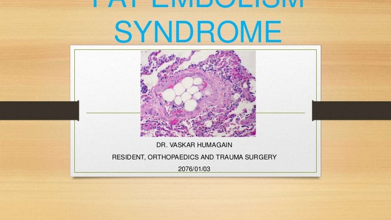 Fat embolism and Fat Embolism Syndrome