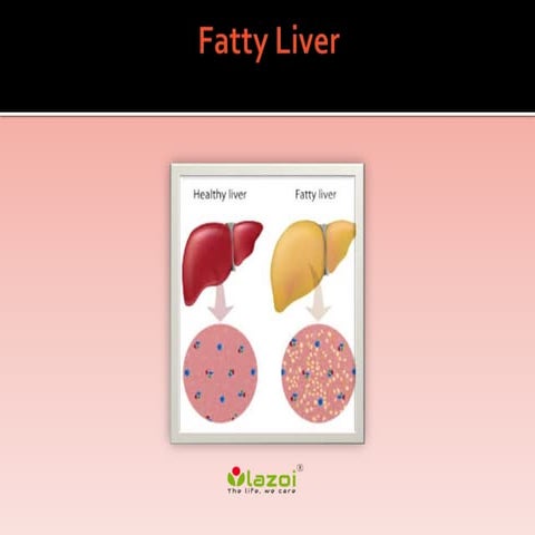 Fatty liver