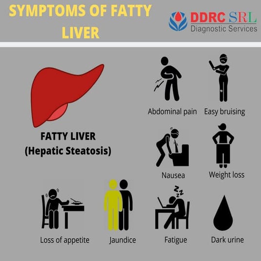 Symptoms Of Fatty Liver Hepatic Steatosis Pdf