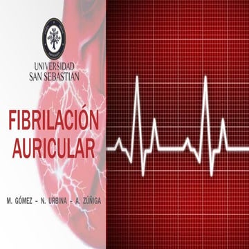 Fibrilación Auricular