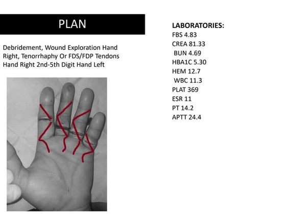 Kleinert and Duran Protocols.pptx