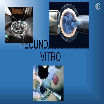 Fecundacion in vitro