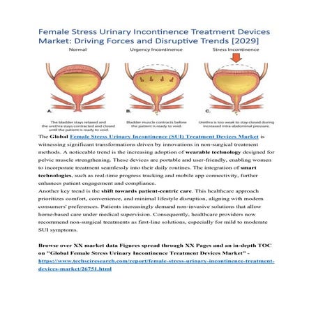 Female Stress Urinary Incontinence Treatment Devices Market | PDF
