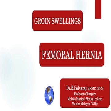 Femoral hernia - Groin swellings