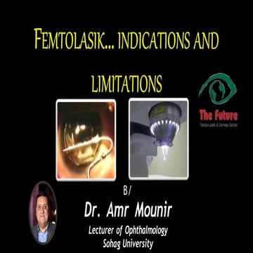 femtolasik-200612142938.pptx in glaucoma | PPTX