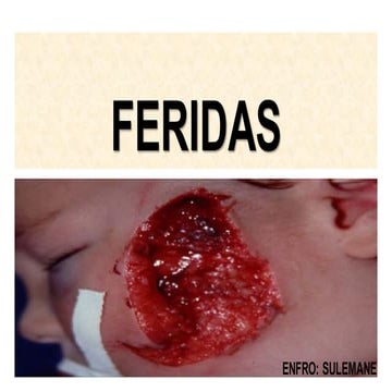 FERIDAS__E_GANGRENA_2018 e Tratamento.pdf