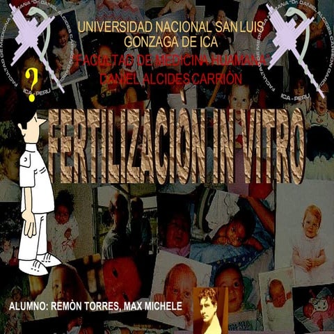 Fertilizacion In Vitro