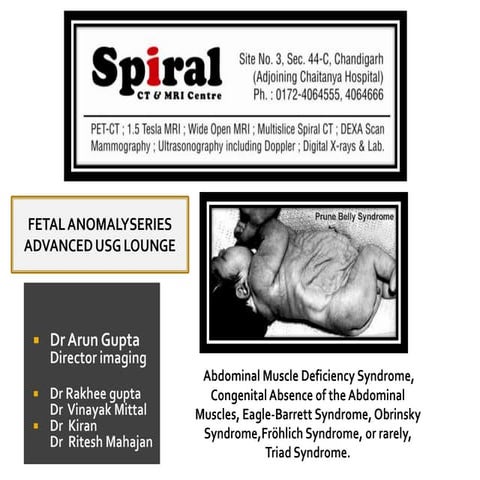 Fetal anomaly series prune  belly syndrome.