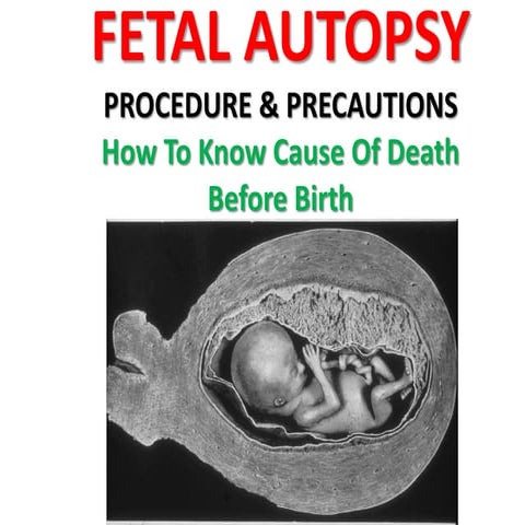 Fetal autopsy