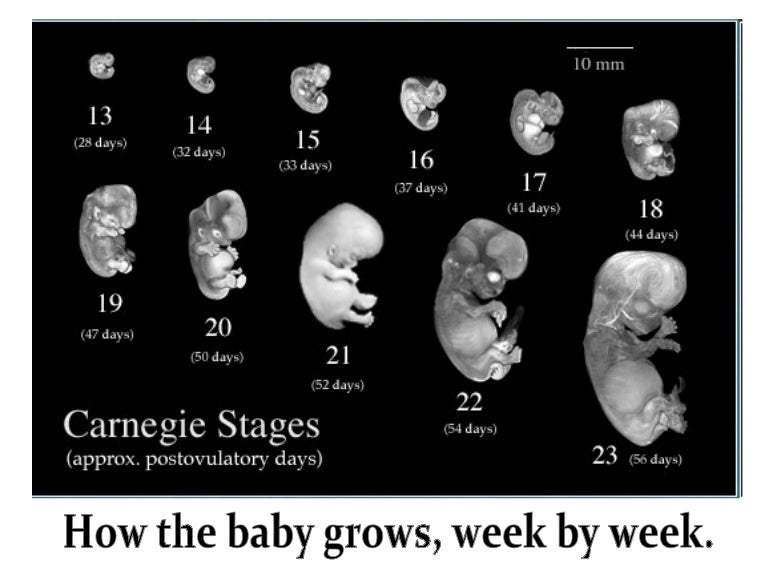 Diagram Diagram Of A Growing Fetus Full Version Hd Quality Growing Fetus Snadiagram 2milionidipremi It