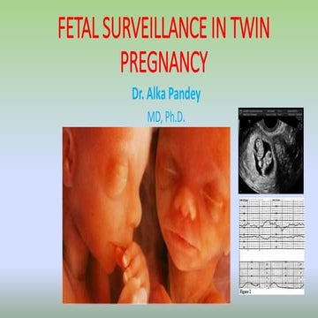 Fetal surveillance in twin pregnancy