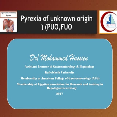 Pyrexia of unkown origin by Dr mohammed Hussien