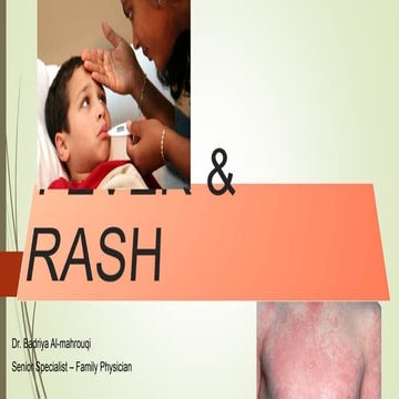 Fever & Rash | PPTX