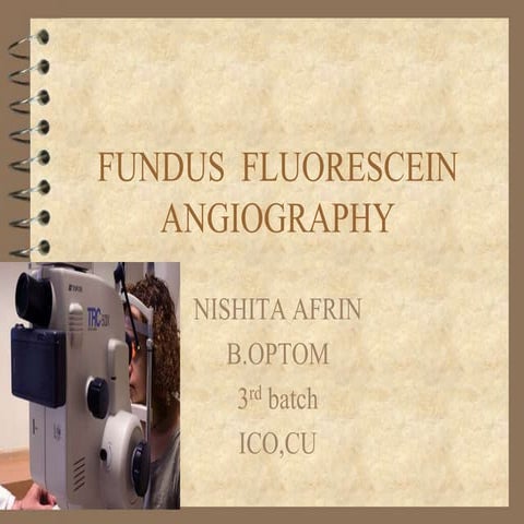 FUNDUS FLUORESCEIN ANGIOGRAPHY