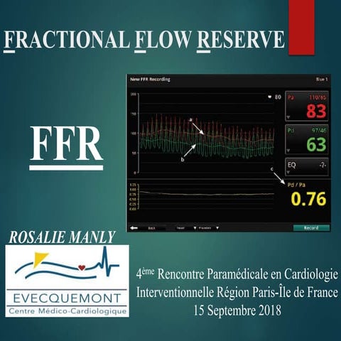 FFR et EI | PDF