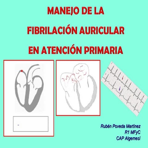 Fibrilacion auricular | PPT