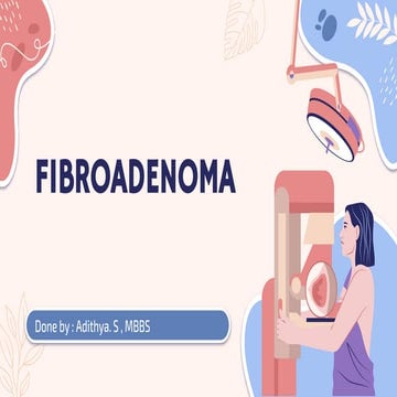 fibroadenoma.pptx