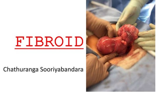 complications and degerations of fibroids | PPTX | Pregnancy ...