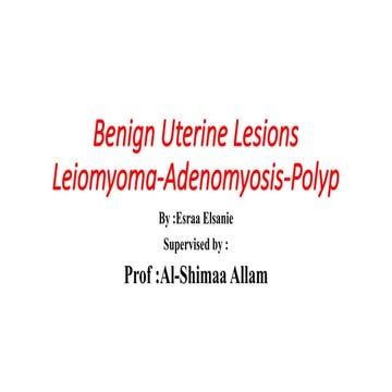 fibroid invstigation and surgical treatment.pptx