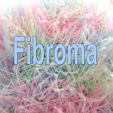 Fibroma- benign tumors