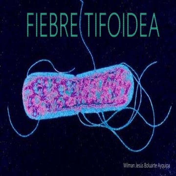 Fiebre tifoidea medicina interna 2(seminario ppt)