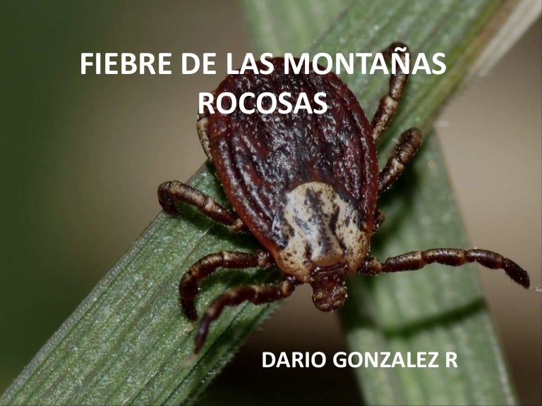 Fiebre de las montañas rocosas Fiebre de las montañas rocosas