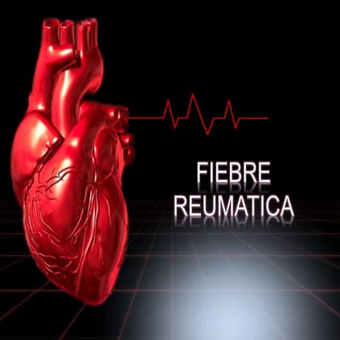 Fiebre reumatica 