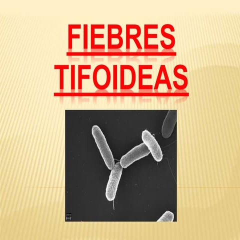 Fiebres tifoideas