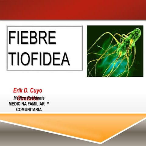 Fiebre tifoidea