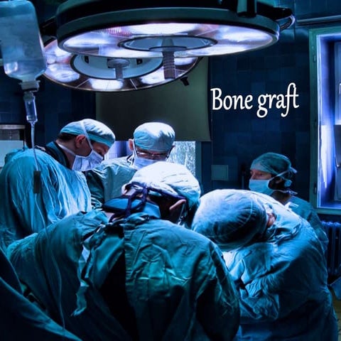 application of bone graft in dentistry