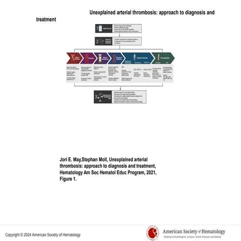 Arterial thrombi in details#MkindiArterial thrombi#Mkindi  Arterial thrombi#M...