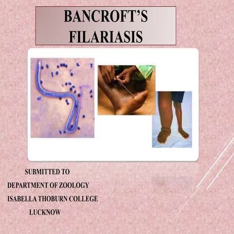 Filariasis ( wuchereria bancrofti)