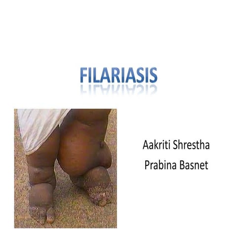 filariasis.pdf HEY THIS IS SLIDE OF FILARISIS