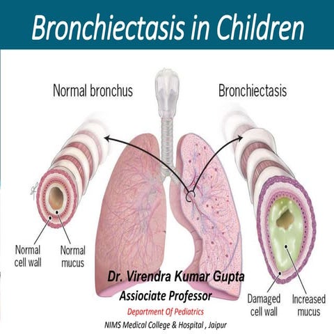 Bronchiectasis
