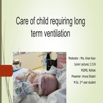 care of child on ventilator