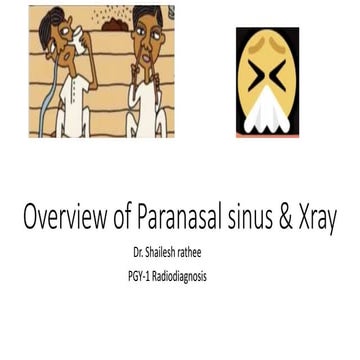 Overview  of Paranasal sinus Radiology.pptx